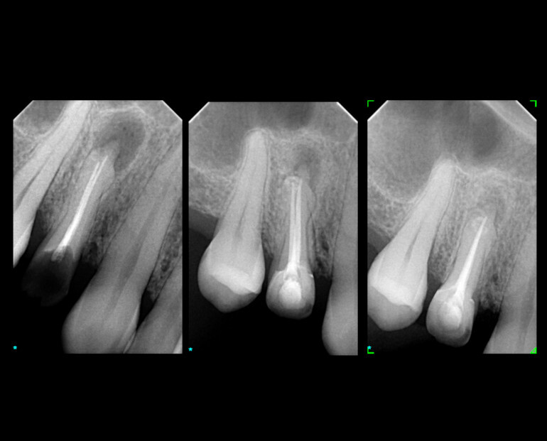 Endodontia