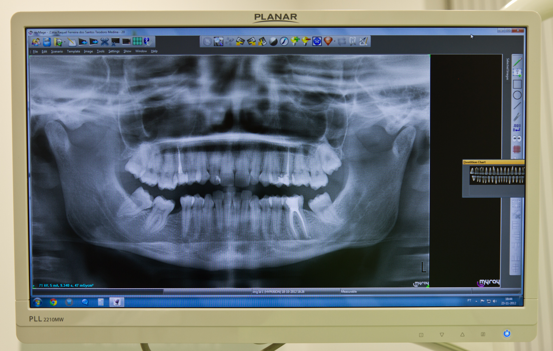 Medicina Dentária Preventiva - XL Smile